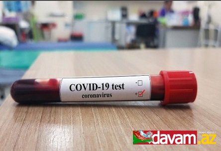 Ukraynada son sutkada 343 nəfər koronavirusa yoluxub