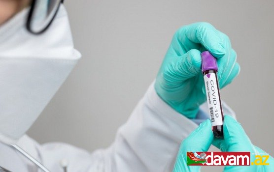 Son sutkada Qırğızıstanda koronavirusa 719 nəfər yoluxub