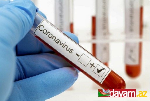 Amerikada son sutkada koronavirusdan 540 nəfər ölüb